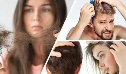 Sarımsaklı Şampuan Tarifi: Dökülen Saçların Yerine Daha Fazlasını Çıkaran Doğal Mucize! 7