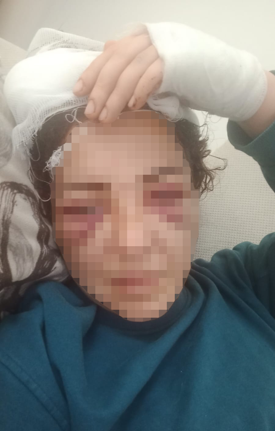 Elektronik kelepçeyi kırıp karasını yaraladı!