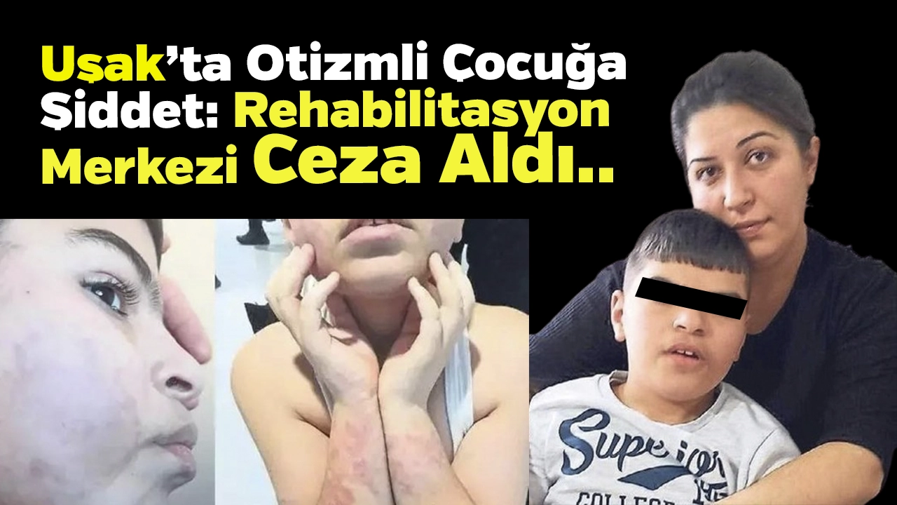 Uşak’ta Otizmli Çocuğa Şiddet.. Anne: Ceza Yetersiz..