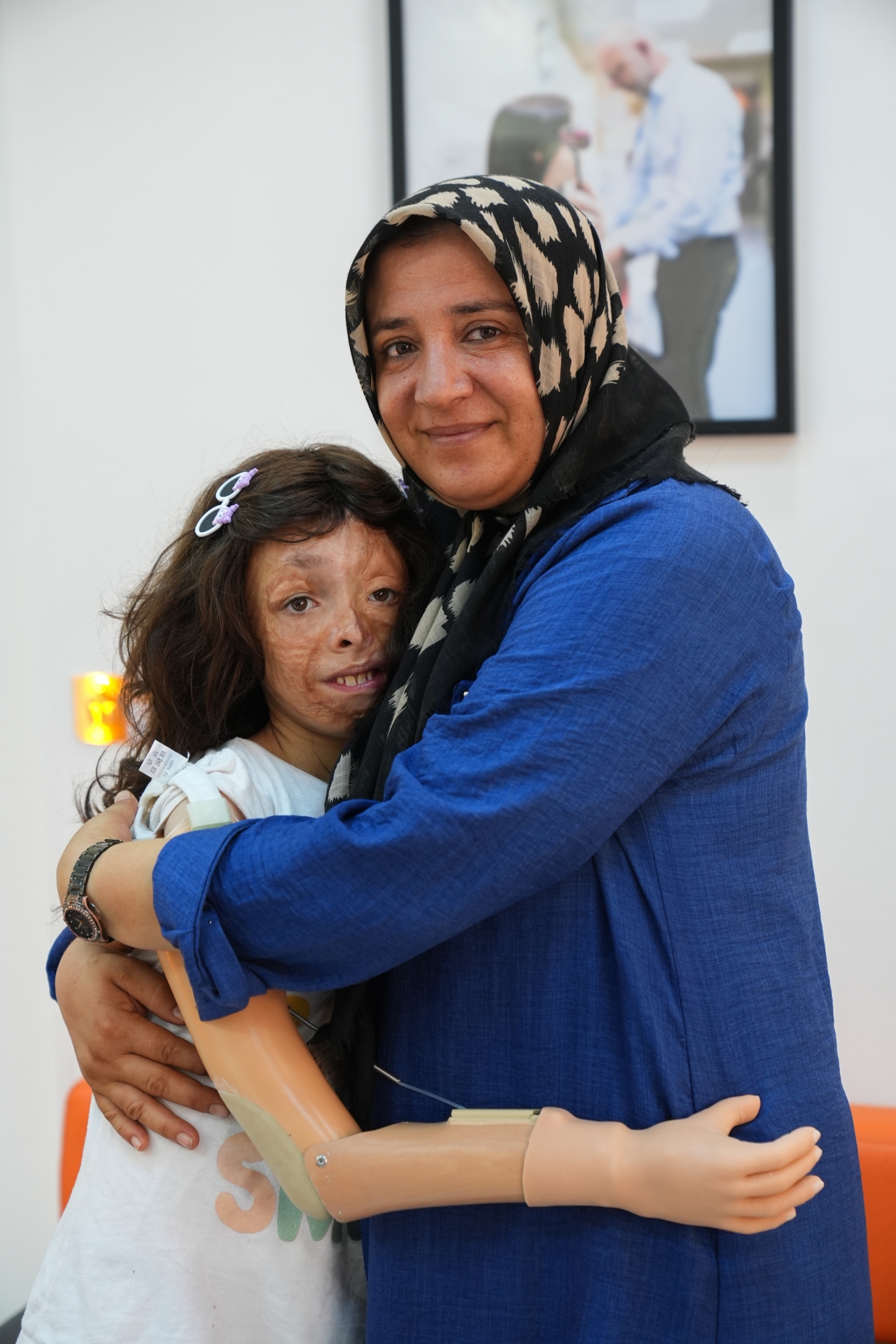 Saçlarının ardından protez koluna kavuşan küçük Sinem, ilk kez annesine sarıldı