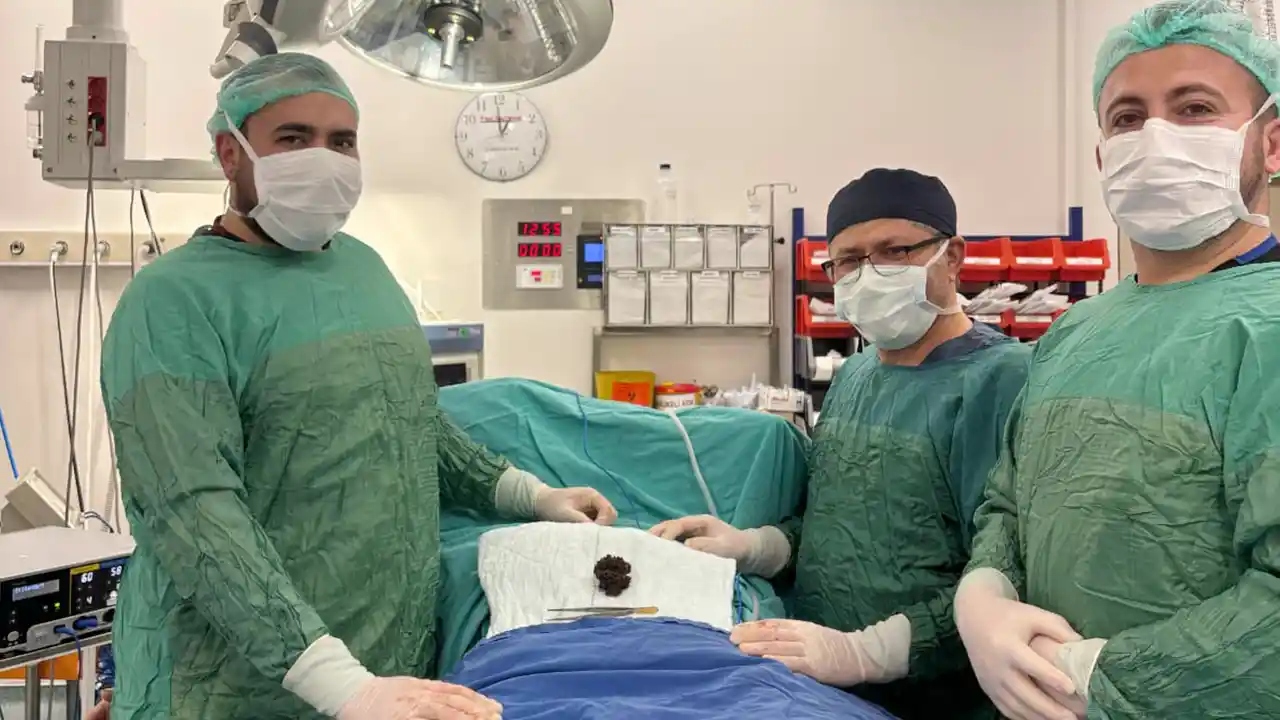 Sandıklı'da 80 yaşındaki hastanın mesanesinden 7 santimetrelik taş çıkarıldı
