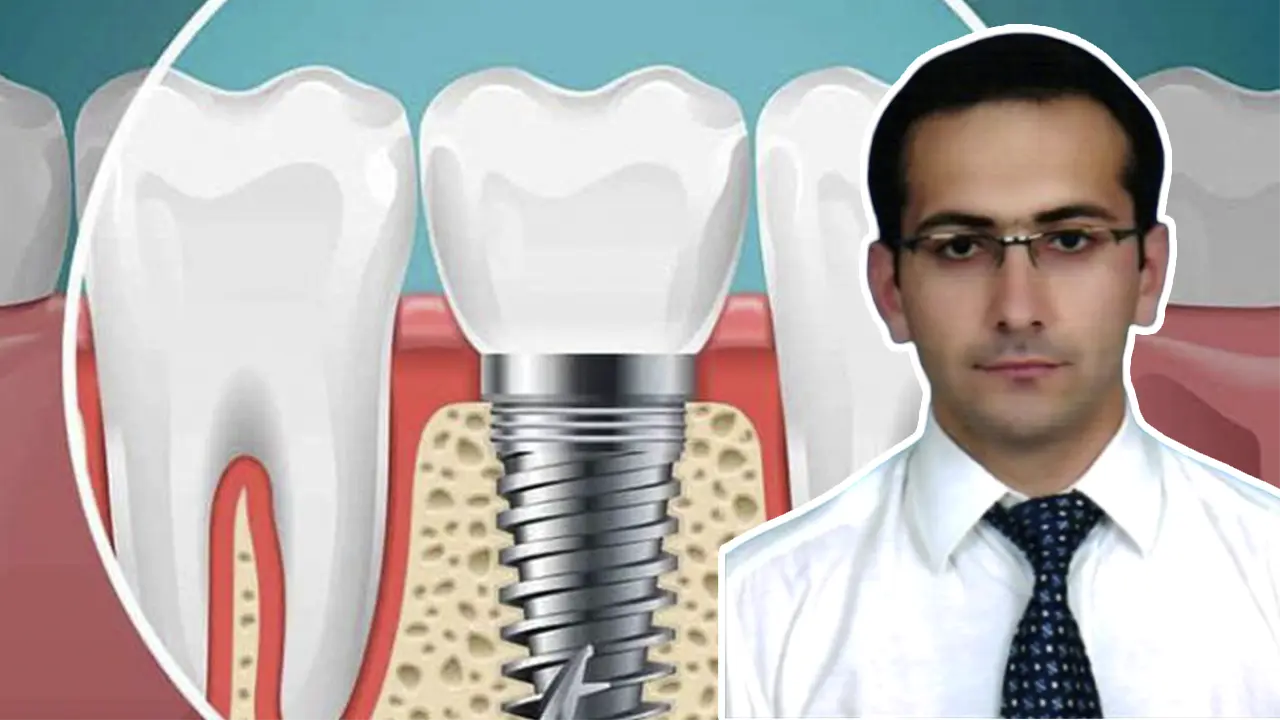 Uşak Diş Hekimliği Fakültesi’nde İmplant Çakma Rekoru!