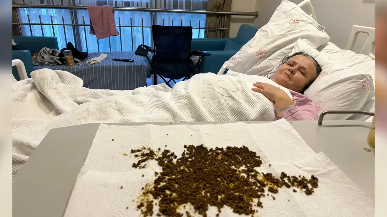 Manisa'da hastanın safra kesesinden binlerce taş çıkarıldı