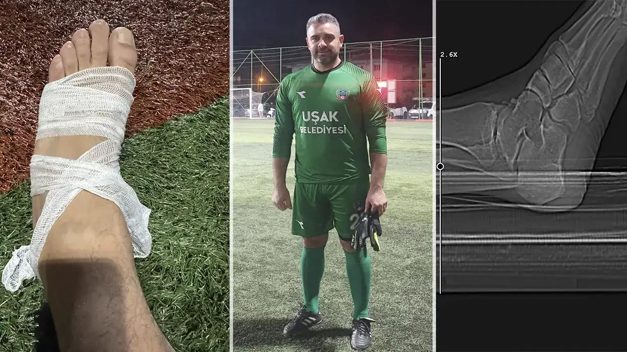 Uşak Master Ligi’nde Ayağı Kırılan Kaleciye Bir de Kırmızı Kart!