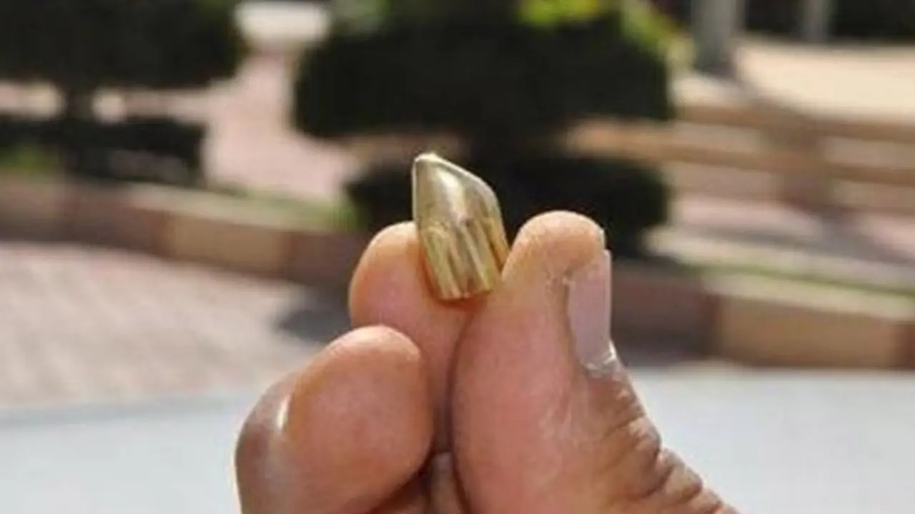 Otel Bahçesinde Yorgun Mermi İsabet Eden Kadın Yaralandı